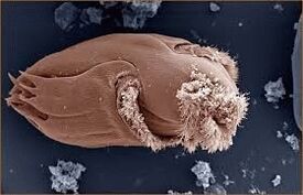Microorganismos patóxenos en humanos