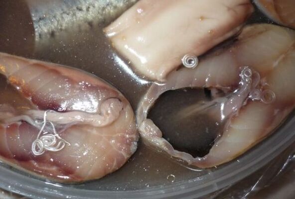 vías de infección humana por parasitos