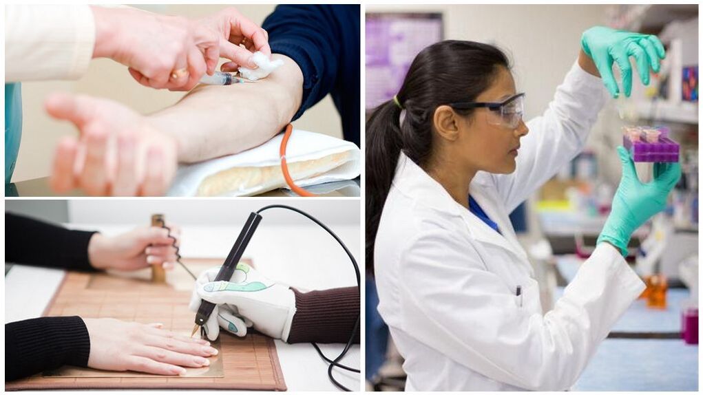 Métodos de diagnóstico para detectar parasitos no corpo