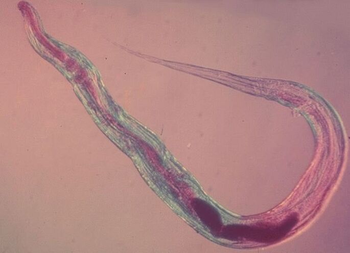 Oxiuro baixo o microscopio