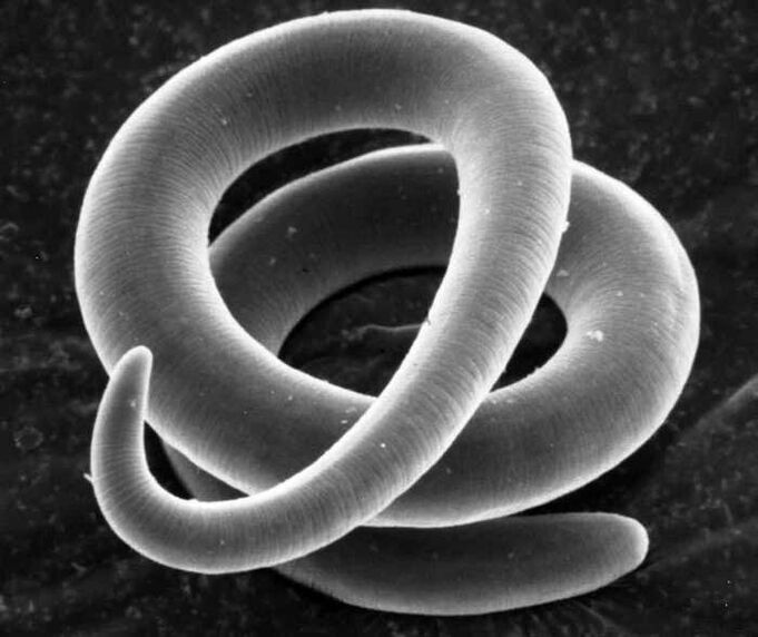 Trichinella ao microscopio